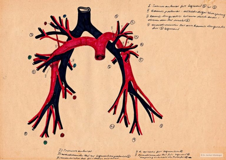 Bronchialbaum., Anatomische Skizze von Herbert Wiedergut.