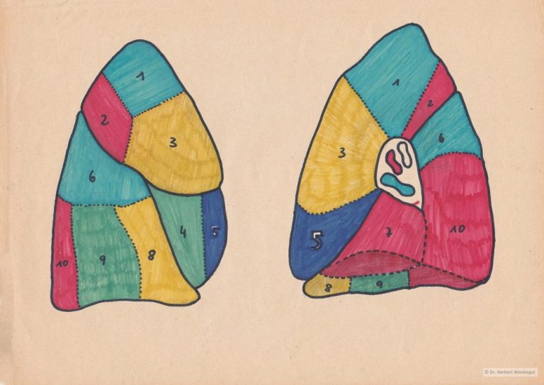 Bunte grafische Darstellung der rechten Lunge mit Segmenten. Anatomische Skizze von Herbert Wiedergut.